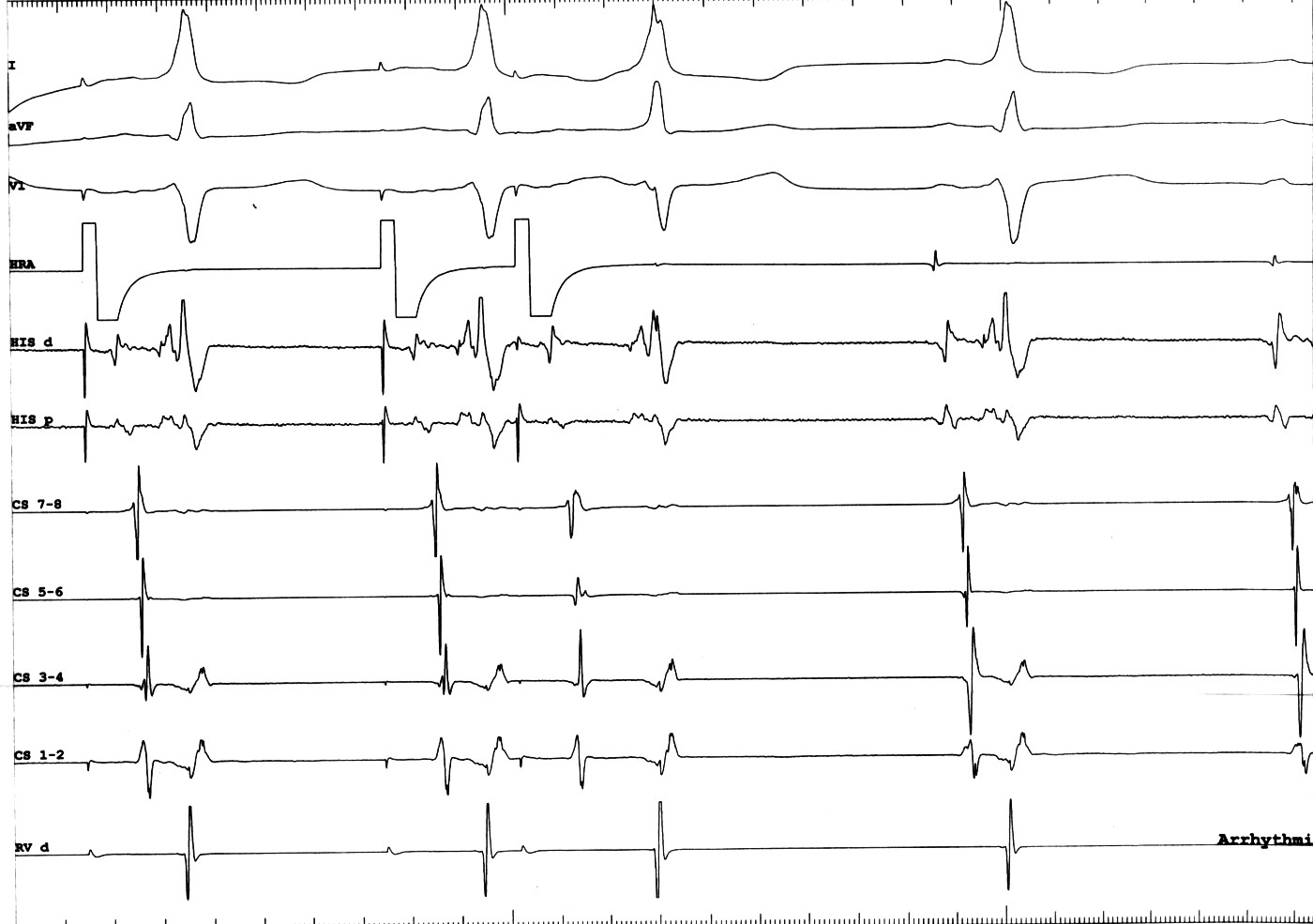 naveen _fv_pathway.jpg